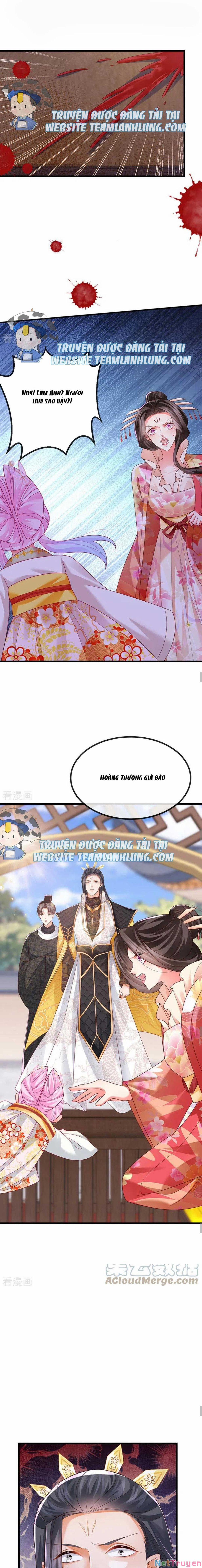 100 Cách Ngược Tra Nữ 63 trang 11