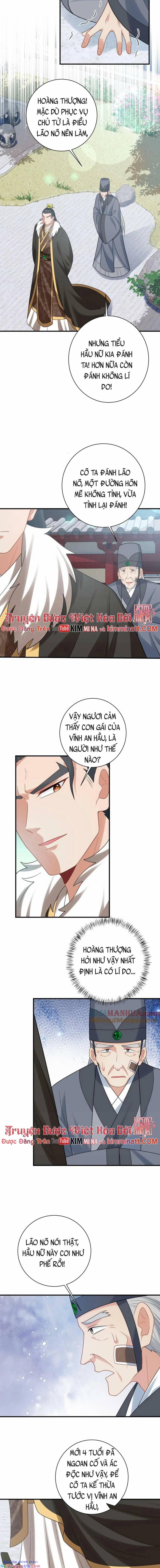 3 Kiếp Xui Xẻo, Kiếp Này Cùng Ta Thần Kinh 108 trang 1