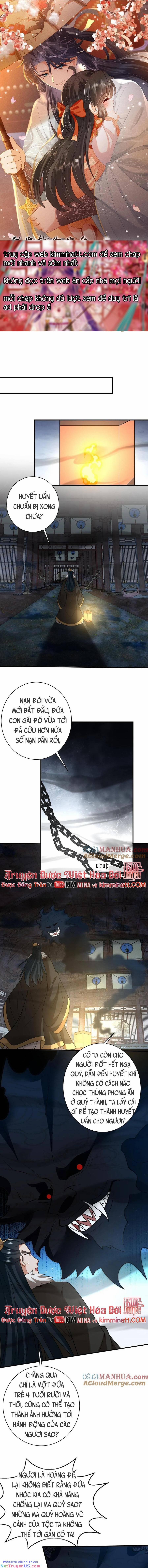 3 Kiếp Xui Xẻo, Kiếp Này Cùng Ta Thần Kinh 138 trang 0