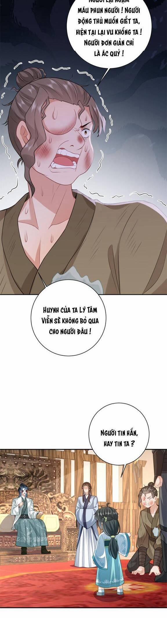 3 Kiếp Xui Xẻo, Kiếp Này Cùng Ta Thần Kinh 22 trang 11