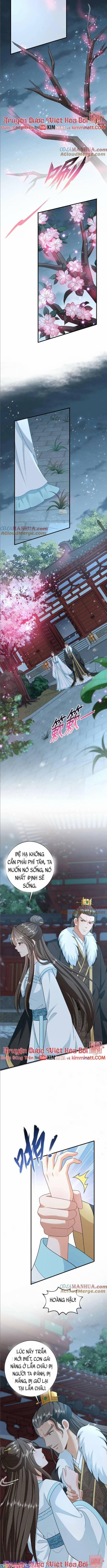 3 Kiếp Xui Xẻo, Kiếp Này Cùng Ta Thần Kinh 87 trang 1