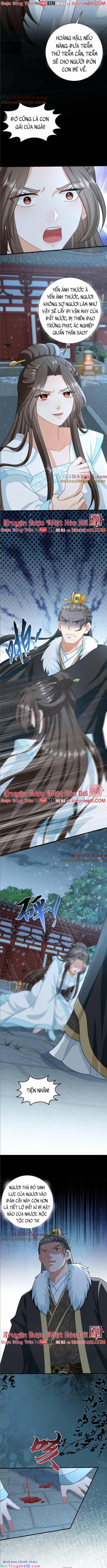 3 Kiếp Xui Xẻo, Kiếp Này Cùng Ta Thần Kinh 87 trang 2