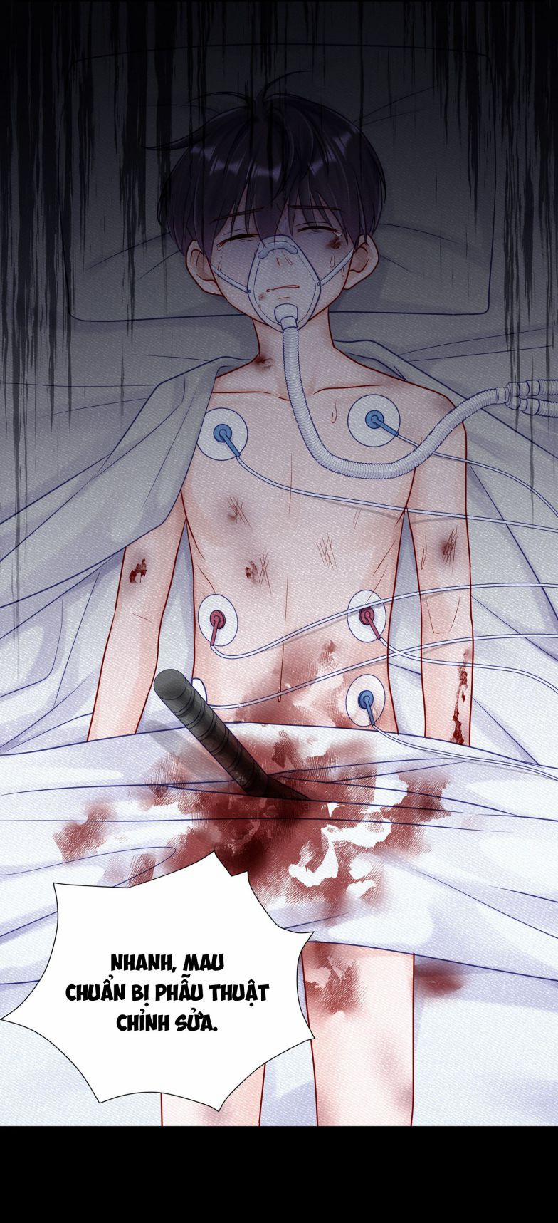 Để Ý Tôi Chút Nào 57 trang 14