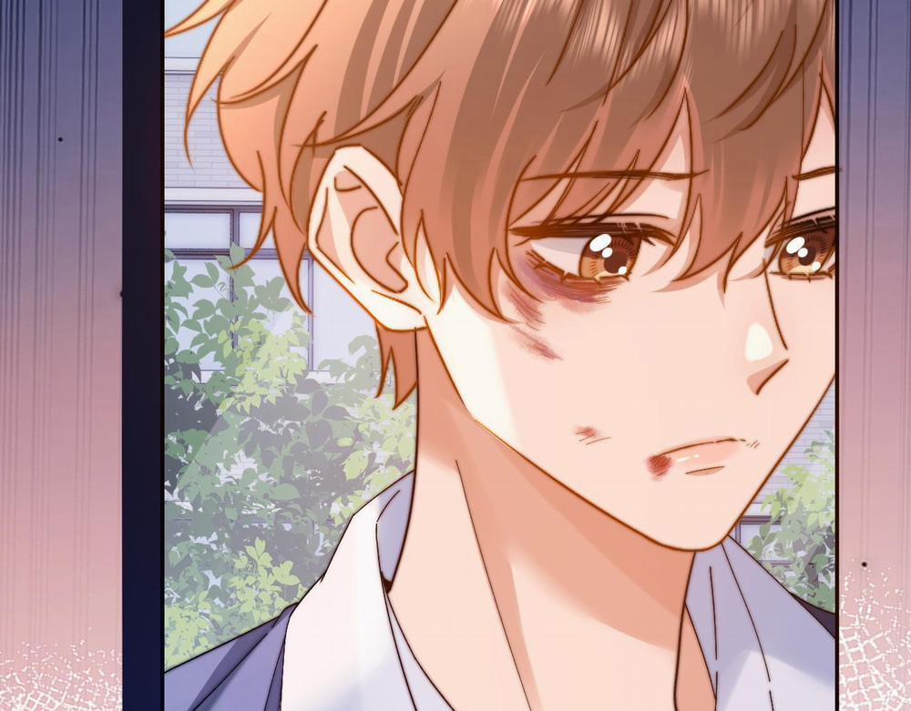 (Drop) Chất Dị Ứng Cực Cute 35 trang 52