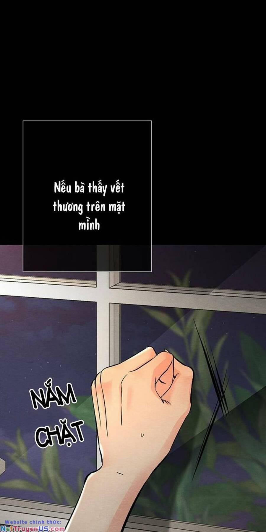 Hoàng Tử Có Vấn Đề 30.1 trang 71