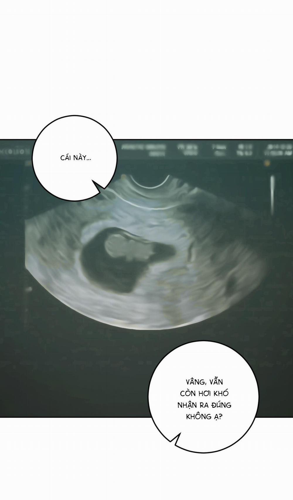 Khu Rừng Tĩnh Lặng 34 trang 18