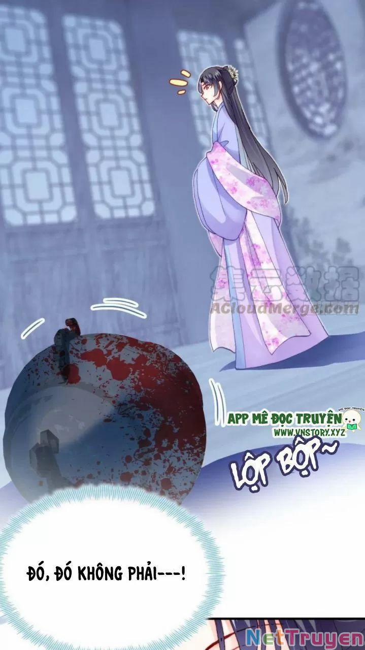 Lại Bị Bệnh Chiều Chuộng Quấn Lấy 0 Hồi ức cấm địa trang 43