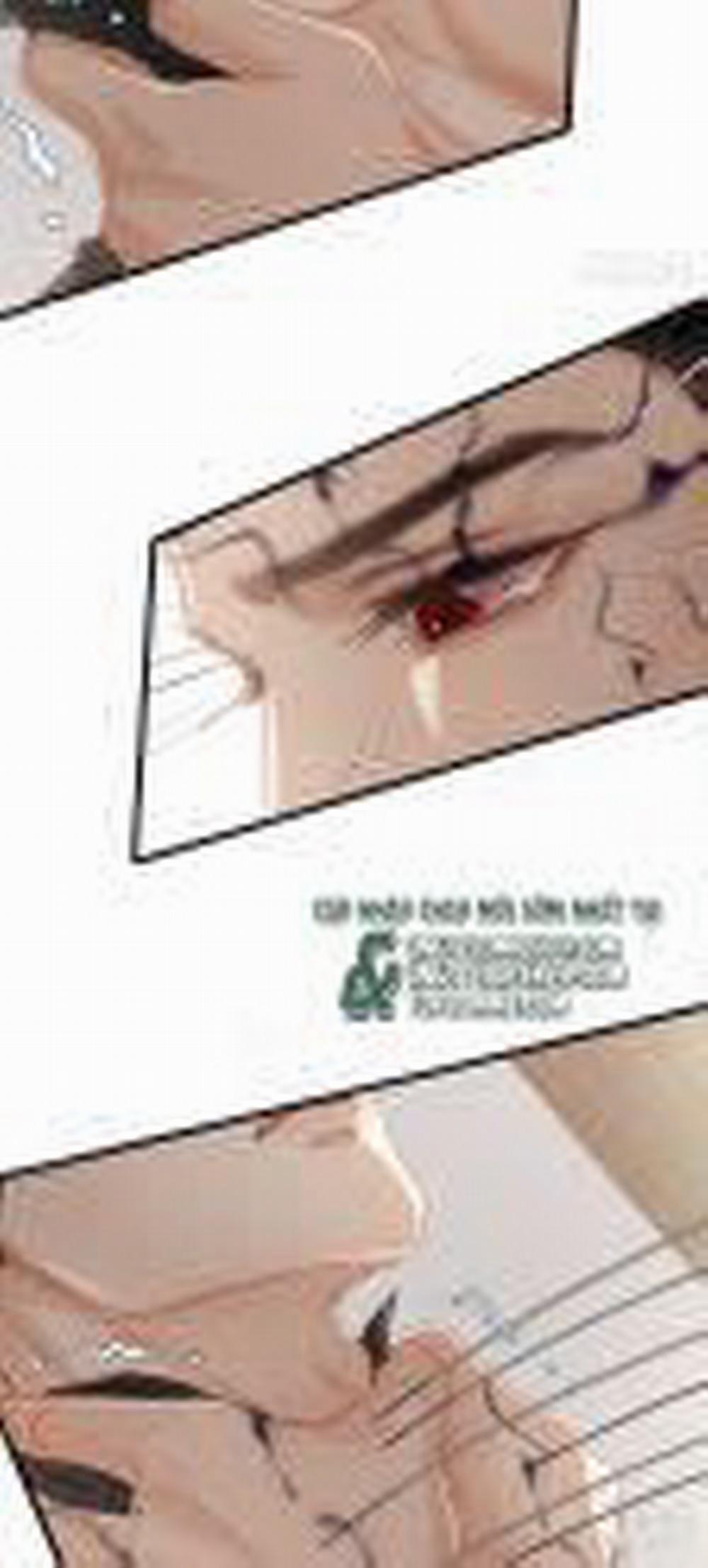 Ngày Dài Gặp Người Khuyết Tâm Nhãn 10 trang 5