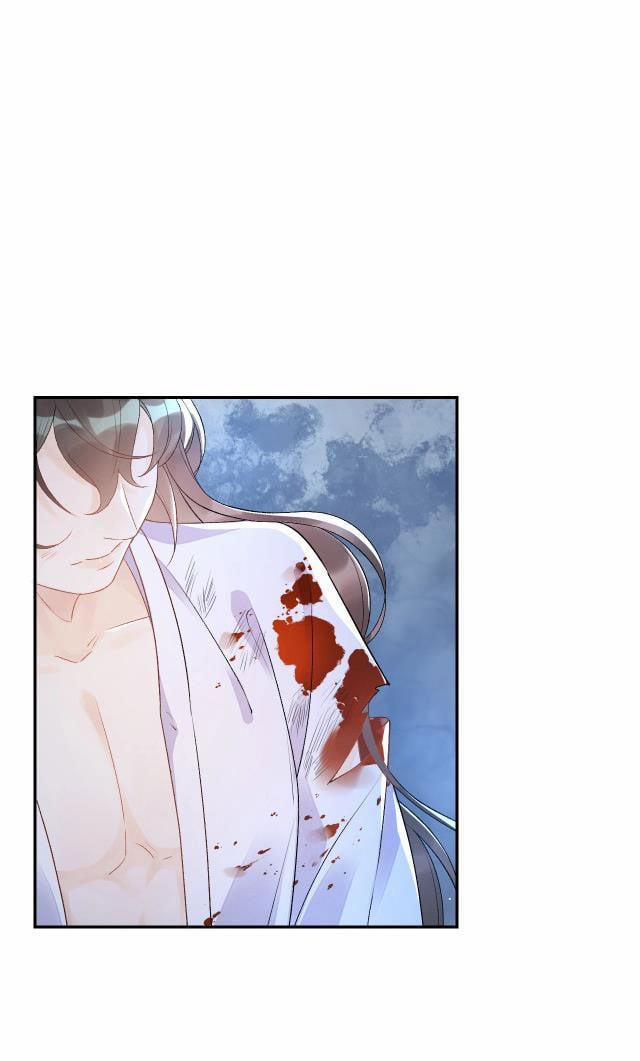 Nội Thị Mỗi Ngày Đều Muốn Cách Xa Hoàng Thượng 7 trang 7